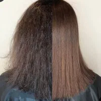 پکیج الماس موخوره گیری فقط ۳۹۹