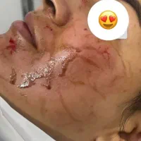 پاکسازی تخصصی درمانی پوست و ماساژصورت وبدن|خدمات آرایشگری و زیبایی|تربت‌حیدریه, نواب صفوی|دیوار