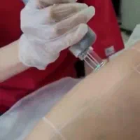 جشنواره تخفیف لیزر موهای زائد (الکساندرایت گرویتی)|خدمات آرایشگری و زیبایی|تهران, جردن|دیوار