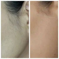 اموزش تخصصی پوست یاسمینا