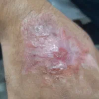 تزریقات وپانسمان در منزل|خدمات آرایشگری و زیبایی|نجفآباد, قدس|دیوار