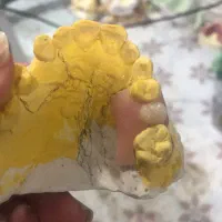 ساخت پروتز مصنوعی|پزشکی|آمل, |دیوار