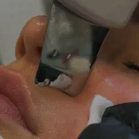 آموزش فیشال پاکسازی پوست