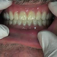 دندان پزشکی لبخند سفید|خدمات آرایشگری و زیبایی|ماهنشان, |دیوار