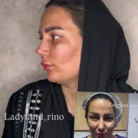 جشنواره جراحی بینی۲۵ تومن .جراحی صورت واندام