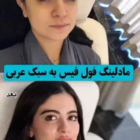 پکیج طلایی نقره ایی برنز لیفت با فیلر ژل بوتاکس|خدمات آرایشگری و زیبایی|مشهد, سناباد|دیوار
