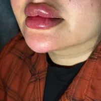 فیلر هر برندی مشتری بخواد|خدمات آرایشگری و زیبایی|یاسوج, |دیوار