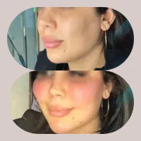 جراحی لابیا پلاستی .چربی صورت وبدن|خدمات آرایشگری و زیبایی|رباط‌کریم, رباط‌کریم|دیوار