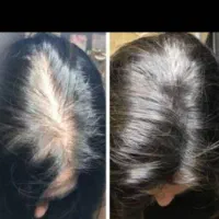 خدمات اسکالپ سر- پر کردن جاهای خالی سر با پیگمنت