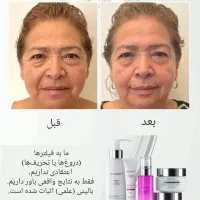 پوستت لایق یه تغییر خاصه|خدمات آرایشگری و زیبایی|شاندیز, |دیوار