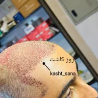 جشنواره‌پایزه‌کاشت‌موریش‌وابروشیرازی‌دراردبیل‌قساط|خدمات آرایشگری و زیبایی|اردبیل, |دیوار