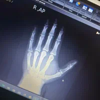 شکسته بندی شبانه روزی کریمی