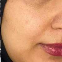 درمان ریزش مو و لک پوستی با محصولات اصل تراست|آرایشی، بهداشتی، درمانی|قدس, شهر‌قدس|دیوار