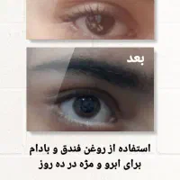 درمان اصلی ریزش مو|آرایشی، بهداشتی، درمانی|شوشتر, |دیوار