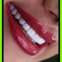 کامپوزیت دندان/لمینیت/دندانپزشکی/ترمیم/عصبکشی|خدمات آرایشگری و زیبایی|تهران, جردن|دیوار