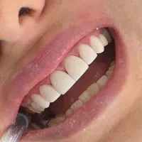 دستیار دندانپزشکی بلوار فردوس