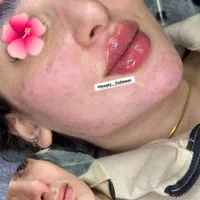 تزریق ژل لب و بوتاکس|خدمات آرایشگری و زیبایی|شیراز, شهرک مهدی‌آباد|دیوار