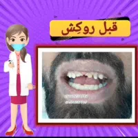 دندان پزشکی دندان مصنوعی|خدمات آرایشگری و زیبایی|تهران, عباس‌آباد|دیوار