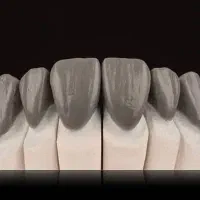 آموزش دندانسازی(پرسلن‌گذاری )