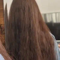 مشاوره  تحصصی رایگان پوست ومو