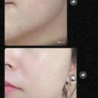 کرم شب آیسل پلاس|آرایشی، بهداشتی، درمانی|ایرانشهر, |دیوار