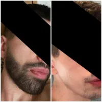 رشـد و رویـش ریـش و سبیـل