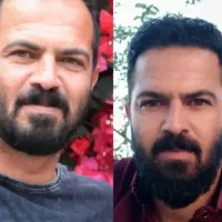 کاشت مو و ابرو بدون جراحی و بخیه با دستگاه