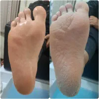 پدیکور و کفسابی پا|خدمات آرایشگری و زیبایی|شاهینشهر, خانه کارگر|دیوار