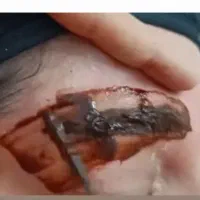 ریموو ابرو بصورت تخصصی بدون آسیب بدون درد|خدمات آرایشگری و زیبایی|بروجرد, |دیوار