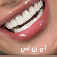 کامپوزیت دندان اقساطی بدون بهره|خدمات آرایشگری و زیبایی|اصفهان, عسگریه|دیوار