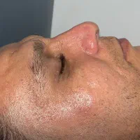 فیشال و پاکسازی اقایان و بانوان|خدمات آرایشگری و زیبایی|اصفهان, دشتستان|دیوار