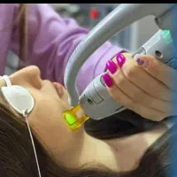 آف 50٪ لیزر کندلا،بدون ژل/شات نامحدود/خانم واقایان