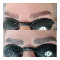 پاک کردن تتو