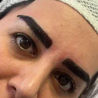 کاشت مو و ابرو|آرایشی، بهداشتی، درمانی|کرج, دانشگاه هنر تهران (پردیس کرج)|دیوار