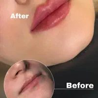 جشنواره فیلر فقط ۸۰۰و بوتاکس فقط ۷۵۰ در مطب