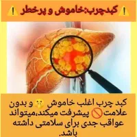 کبد چرب