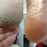 خدمات اسپا و پدیکور|خدمات آرایشگری و زیبایی|شیراز, شهرک ایثار|دیوار