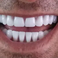 لابراتوار دندانسازی مرادی