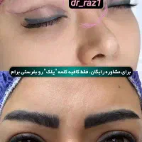 بلفاروپلاستی لیزری توسط جراح و متخصص زیبایی