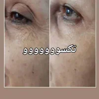 جوان سازی پوست خود را به ما بسپارید|آرایشی، بهداشتی، درمانی|اردبیل, |دیوار