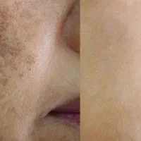 کمتر از ۱۵ روز بدون لک شو
