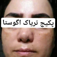 کرم ضدلک تریاک اگوستا