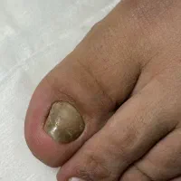 پدیکور و پدولوژی آقایان و بانوان