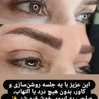 میکروبلیدینگ وروشن سازی تتو تیره بدون نیازبه ریموو|خدمات آرایشگری و زیبایی|بندرعباس, |دیوار