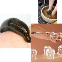 خدمات طب سنتی برای اولین بار در شهرستان سراوان