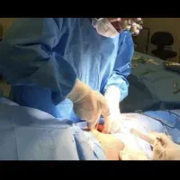 خدمات زیبایی تزریق فیلر آلت تناسلی آقایان