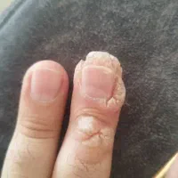 محلول درمان زگیل و زگیل تناسلی|آرایشی، بهداشتی، درمانی|میناب, |دیوار