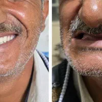 دندان مصنوعی از دم قسط|خدمات آرایشگری و زیبایی|اصفهان, شیخ طوسی|دیوار