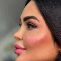پی آر پی مزو امبدینگ هایفو وایتنینگ کربن تراپی|خدمات زیبایی و سلامت|اصفهان, جاوان|دیوار