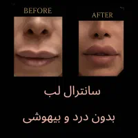 سانترال لب با تخفیف ویژه